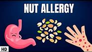 Nut Allergy: Everything You Need To Know