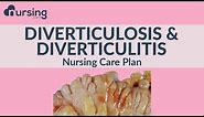 The best way for nurses to care for Diverticulosis and Diverticulitis... Nursing Care Plan