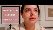 Life Update - Ovarian Dermoid Cyst, Symptoms, & Surgery