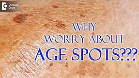 What are age spots? Can you get rid of age spots? - Dr. Nischal K