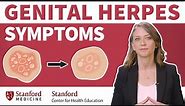 Genital Herpes: Signs and symptoms | Stanford Center for Health Education