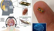 New wireless brain implants could bring mind control to new level: study