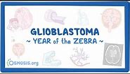 Glioblastoma (Year of the Zebra)