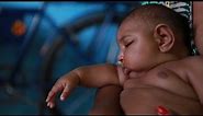 Zika virus linked to birth defect in newborns