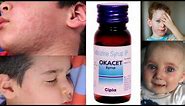 Cetirizine Syrup | Okacet Syrup To Relieve Itching , Redness , Hives , Sneezing , Cold & Allergy |