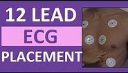 12 Lead ECG Placement of Electrodes | EKG Sticker Lead Procedure