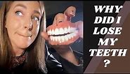 Why did I lose my teeth at age 26?