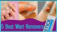 Top 5 Best Wart Removers of 2022 Reviews In 2022