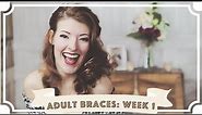 Adult Braces: What It's Really Like (Week 1) [CC]