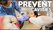 5 Simple Ways To Prevent Cavities