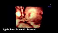 My 17th Week of Pregnancy (3D/4D Ultrasound)