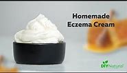 DIY Eczema Cream: A Homemade Natural Solution That Works!