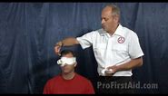 Eye Injuries - First Aid
