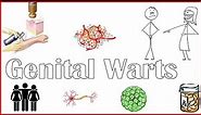 Genital Warts - Causes, Risk Factors, Signs & Symptoms, And Treatment