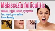 Malassezia folliculitis causes, symptoms, diagnosis, treatment, prevention, and home remedy option
