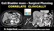 Gall Bladder cancer Surgical planning on CT scan- Triphasic CT liver protocol - Correlate clinically