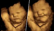 Babies smile over carrots and scowl over kale inside the womb