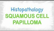 Squamous cell papilloma histopathology features
