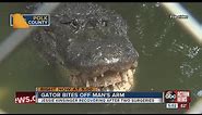 Man running from Lakeland police gets arm bitten off by gator