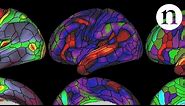 The ultimate brain map