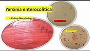 Yersinia enterocolitica colony Morphology, Motility and Gram Staining