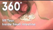 Small intestine with intestinal worms 360 VR |Intestinal Parasites |medical animation #intestin #360