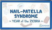 Nail-Patella syndrome (Year of the Zebra)