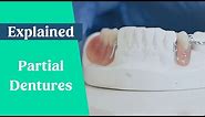 Partial dentures & false teeth explained