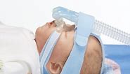 Application video of the BabyFlow plus - the superior solution for non-invasive respiratory support