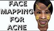 Face Mapping For Acne