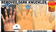 dark knuckles treatment with carotone dark spot corrector x piment doux serum