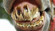 Rasping, ageing and helping the long in the tooth: 8 key questions answered about horses’ teeth