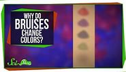 Why Do Bruises Change Colors?
