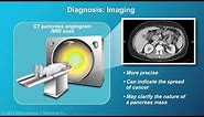 Pancreatic Cancer: Pathophysiology, Diagnosis and Staging