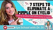 7 Steps to eliminate that bump on eyelid | Pimple on Eye? What to do about white bump on your eyelid