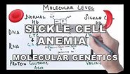 Sickle Cell Anemia - Molecular Mechanism