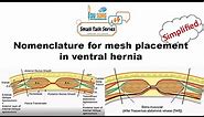 Ventral hernia surgery - Planes for mesh placement - Terminology demystified