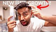 How To Use a Derma Roller and Minoxidil For Hair Growth