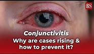 Conjunctivitis: Why are cases rising & how to prevent it?