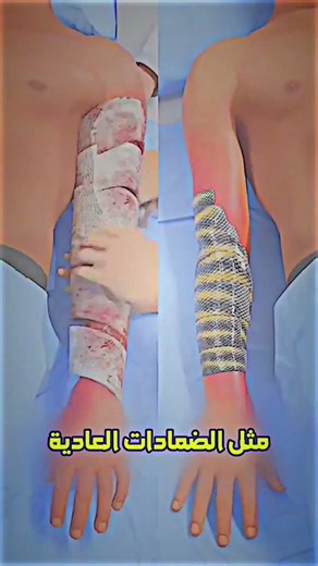 "هذا الفرق بين جلد السمك و ضماضات العادية 😱#معلومات #shorts