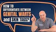 How to differentiate between genital warts and skin tags