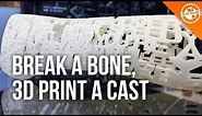 Social, 3D Printed Cast for Broken Bones