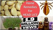 Top 5 Home Remedies To Get Rid Of Head LICE & Nits * Sushmita's Diaries