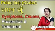 Pubic lice (Crabs) जघन जूँ - Symptoms, Causes, Prevention & Treatment - Dr. Richa Gupta | Lybrate