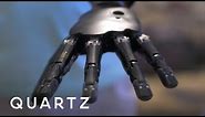Living with a mind-controlled robot arm