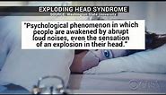 What's "exploding head syndrome"?