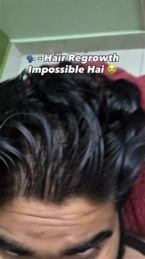 Effective Solutions for Hair Fall Prevention