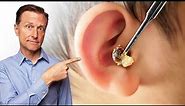 What Does LOTS of EARWAX Buildup Mean?