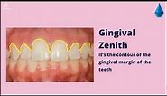 Drop #167 PAPILLAE ANALYSIS AND GINGIVAL ZENITH