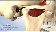 TMJ Disorder or TMD - Clicking and Closed Lock